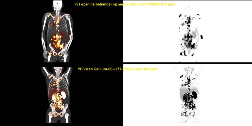 Lutetium en gallium